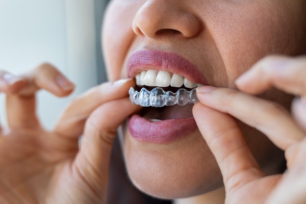 Am I A Candidate For Clear Aligners?